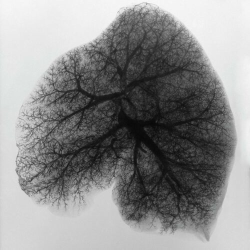 Leading Change Revatio Case Study. Picture of lung from Science Photo Library